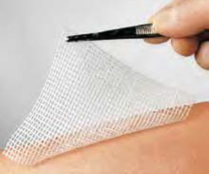 Moderne Wundversorgung