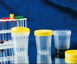 Urinbecher Laborbecher