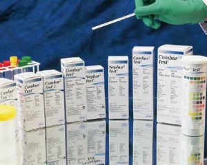 combur_urinteststreifen_roche