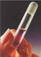 gewebekleber_hautkleber