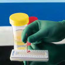 haematokrit_wachsplatte_16