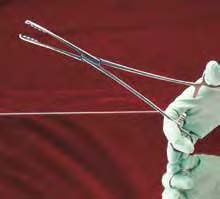 tupferzange_nach_ulrich