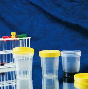 urinbecher_mit_schraubdeckel